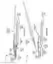 Fig. 35 - Suction device for surgical instruments