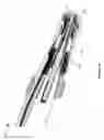 Fig. 45 - Suction device for surgical instruments
