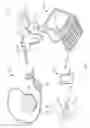 Fig. 02 - Systems comprising an implantable component for treating pulmonary hypertension