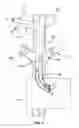 Fig. 05 - Method and apparatus for the dialysis of blood