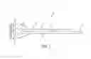 Fig. 02 - ACTUATING CATHETER LUER AND HUB DEVICES