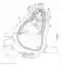 Fig. 02 - Delivery devices and methods for leadless cardiac devices