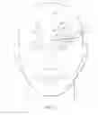 Fig. 09 - Implantable head located radiofrequency coupled neurostimulation system for head pain