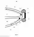 Fig. 09 - Local lead to improve energy efficiency in implantable wireless acoustic stimulators
