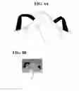 Fig. 06 - Particle filter mask