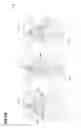 Fig. 06 - Methods for manufacturing a lens, lens manufacturing systems, and lenses