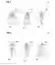 Fig. 07 - Methods for manufacturing a lens, lens manufacturing systems, and lenses