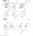 Fig. 08 - Methods for manufacturing a lens, lens manufacturing systems, and lenses