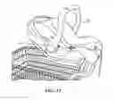 Fig. 12 - Infant carrier transport
