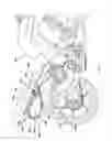 Fig. 11 - Saddlebag support apparatus