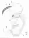 Fig. 08 - Reverse mechanism for a motorcycle with a sidecar