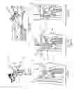 Fig. 10 - Reverse mechanism for a motorcycle with a sidecar
