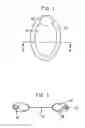 Fig. 02 - Collapsible flotation device