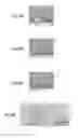 Fig. 05 - Substrate that is electrically conductive on at least one of the faces of same provided with a stack of thin layers for growing carbon nanotubes (CNTs)