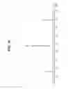 Fig. 17 - Solid forms of a macrocyclic kinase inhibitor