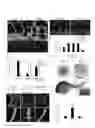 Fig. 02 - Methods for treating inflammatory responses or diseases caused by inflammation using ApoA-I binding protein (APOA1BP)