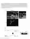 Fig. 08 - Methods for treating inflammatory responses or diseases caused by inflammation using ApoA-I binding protein (APOA1BP)