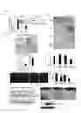 Fig. 13 - Methods for treating inflammatory responses or diseases caused by inflammation using ApoA-I binding protein (APOA1BP)
