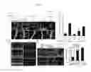 Fig. 20 - Methods for treating inflammatory responses or diseases caused by inflammation using ApoA-I binding protein (APOA1BP)