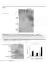 Fig. 23 - Methods for treating inflammatory responses or diseases caused by inflammation using ApoA-I binding protein (APOA1BP)