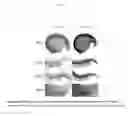 Fig. 31 - Methods for treating inflammatory responses or diseases caused by inflammation using ApoA-I binding protein (APOA1BP)