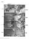 Fig. 02 - Tumor-associated peptides binding promiscuously to human leukocyte antigen (HLA) class II molecules