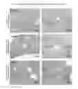 Fig. 38 - Modified FGF-21 polypeptides comprising an internal deletion and uses thereof