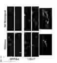 Fig. 142 - COMPOSITIONS OF HUMANIZED NOTCH FUSION PROTEINS AND METHODS OF TREATMENT