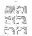Fig. 04 - Methods for inhibiting atherosclerosis by administering an inhibitor of PCSK9