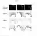 Fig. 07 - Methods for inhibiting atherosclerosis by administering an inhibitor of PCSK9