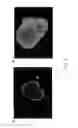 Fig. 10 - DIGITAL MICROFLUIDIC PLATFORM FOR CREATING, MAINTAINING AND ANALYZING 3-DIMENSIONAL CELL SPHEROIDS