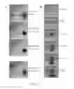 Fig. 13 - DIGITAL MICROFLUIDIC PLATFORM FOR CREATING, MAINTAINING AND ANALYZING 3-DIMENSIONAL CELL SPHEROIDS
