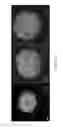 Fig. 15 - DIGITAL MICROFLUIDIC PLATFORM FOR CREATING, MAINTAINING AND ANALYZING 3-DIMENSIONAL CELL SPHEROIDS
