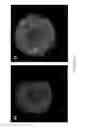 Fig. 16 - DIGITAL MICROFLUIDIC PLATFORM FOR CREATING, MAINTAINING AND ANALYZING 3-DIMENSIONAL CELL SPHEROIDS