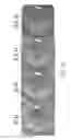 Fig. 17 - DIGITAL MICROFLUIDIC PLATFORM FOR CREATING, MAINTAINING AND ANALYZING 3-DIMENSIONAL CELL SPHEROIDS