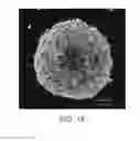 Fig. 19 - DIGITAL MICROFLUIDIC PLATFORM FOR CREATING, MAINTAINING AND ANALYZING 3-DIMENSIONAL CELL SPHEROIDS