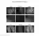 Fig. 11 - Technologies, Methods, and Products of Small Molecule Directed Tissue and Organ Regeneration from Human Pluripotent Stem Cells
