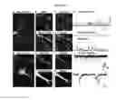 Fig. 09 - Cortical interneurons and other neuronal cells produced by the directed differentiation of pluripotent and multipotent cells