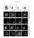 Fig. 11 - Cortical interneurons and other neuronal cells produced by the directed differentiation of pluripotent and multipotent cells