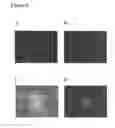 Fig. 07 - REPROGRAMMED CELLS AND METHODS OF PRODUCTION AND USE THEREOF