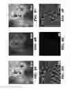 Fig. 08 - Multi-layered cell constructs and methods of use and production using enzymatically degradable natural polymers