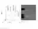 Fig. 04 - ENZYME AND USES THEREOF