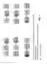Fig. 02 - CHIMERIC FVII-XTEN MOLECULES AND USES THEREOF