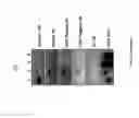 Fig. 11 - Methods and compositions for the treatment of cancer