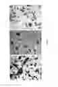 Fig. 38 - Methods and compositions for the treatment of cancer