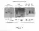 Fig. 08 - PROSTATE CANCER-SPECIFIC ALTERATIONS IN ERG GENE EXPRESSION AND DETECTION AND TREATMENT METHODS BASED ON THOSE ALTERATIONS