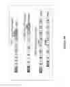 Fig. 11 - PROSTATE CANCER-SPECIFIC ALTERATIONS IN ERG GENE EXPRESSION AND DETECTION AND TREATMENT METHODS BASED ON THOSE ALTERATIONS