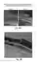 Fig. 10 - RNA interference in ocular indications