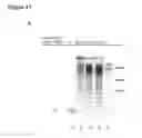 Fig. 69 - Methods and compositions for detection of small RNAS