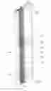 Fig. 04 - Insulating wall, a column assembly therefore and a method of constructing such an insulating wall